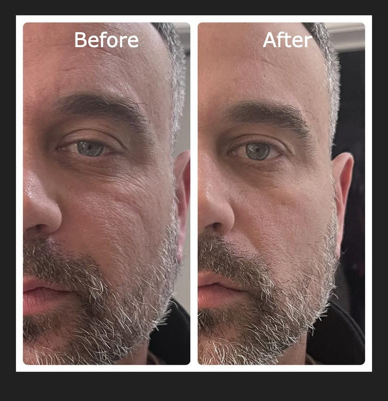 INSTANT Face Lift Tightening Cream