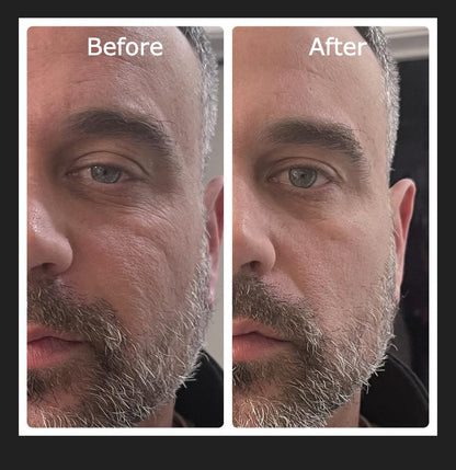 INSTANT Face Lift Tightening Cream